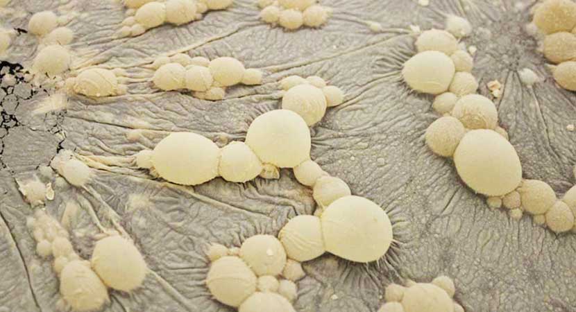 Riconoscere le infezioni